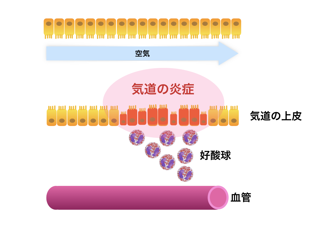 が 出る 痰